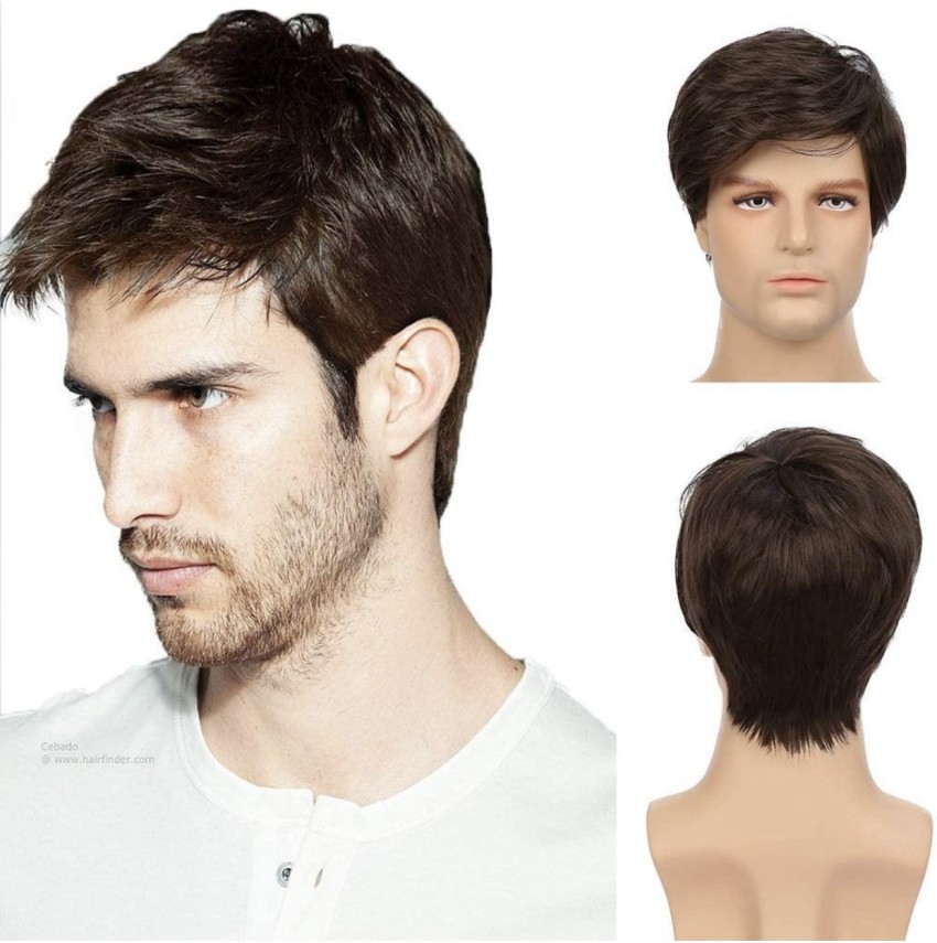 Hair Patch In Delhi - Process, Cost, Success Rate, Time, Results