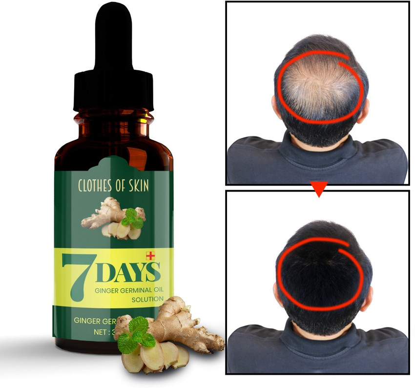 Urban Products 7 Days Ginger Hair Oil Germinal Hair Growth Serum