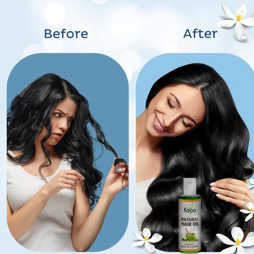 Vitamin e oil black hair hotsell