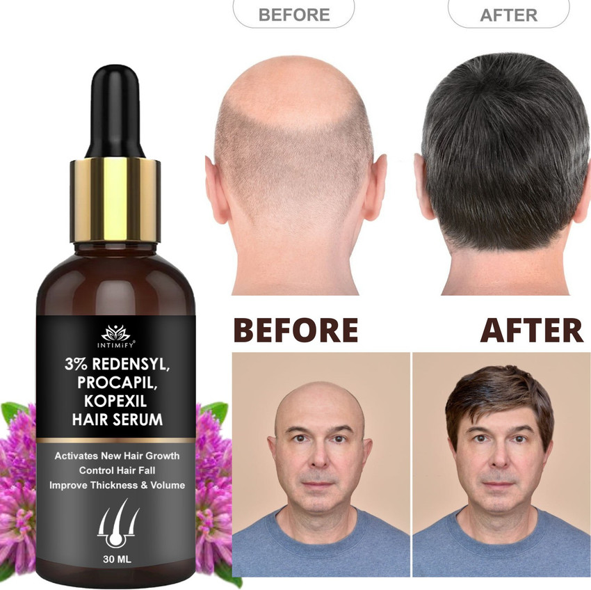 Redensyl deals