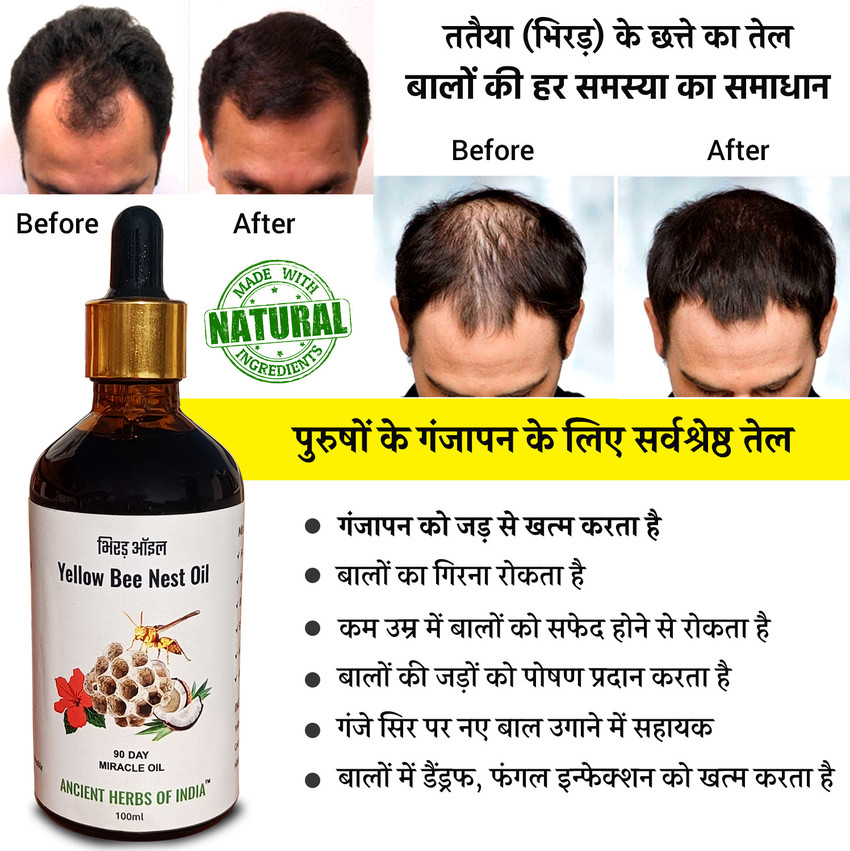 Share 154+ hair fall control in hindi ceg.edu.vn