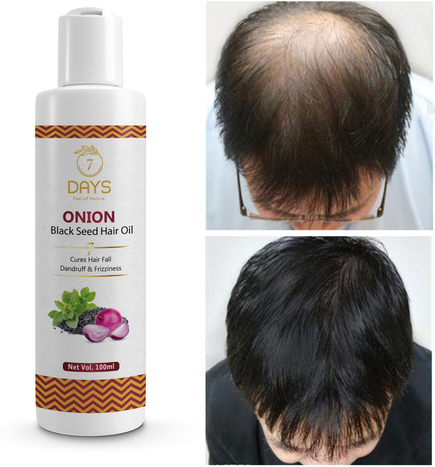 Onion Oil Buy The Indie Earth Red Onion Hair Oil for Hair Growth