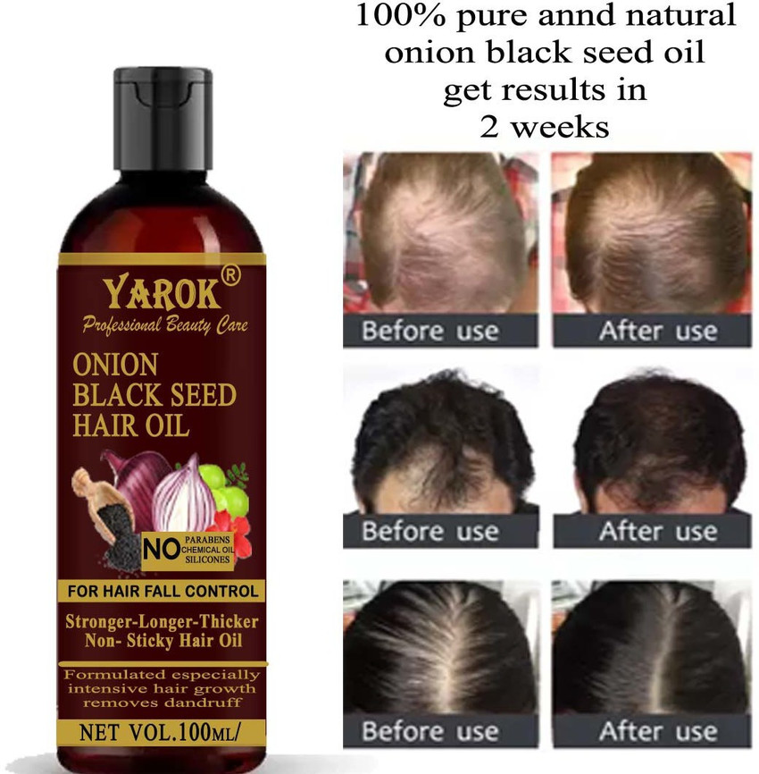 Black seed oil top for hair growth