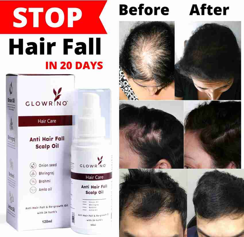 How control hair loss 2025