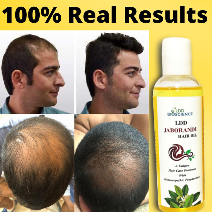 Jaborandi shop hair oil