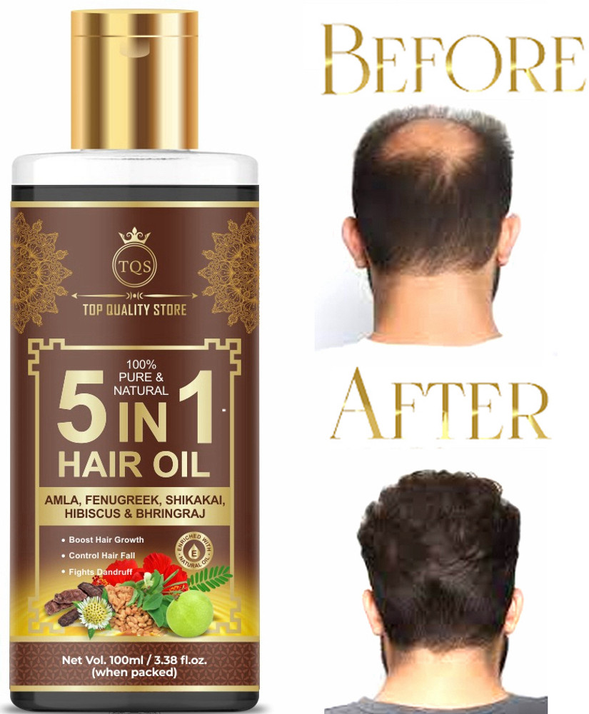 Top Quality Store 5 in 1 Hair Loss Control Long Hair oil Hair Oil Price in India Buy Top Quality Store 5 in 1 Hair Loss Control Long Hair oil Hair