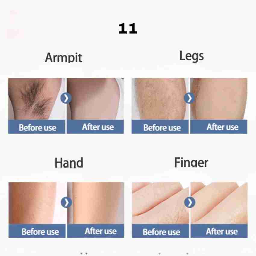 Adi Express Face Hair Removal Women s Upper Lip Hair Removal