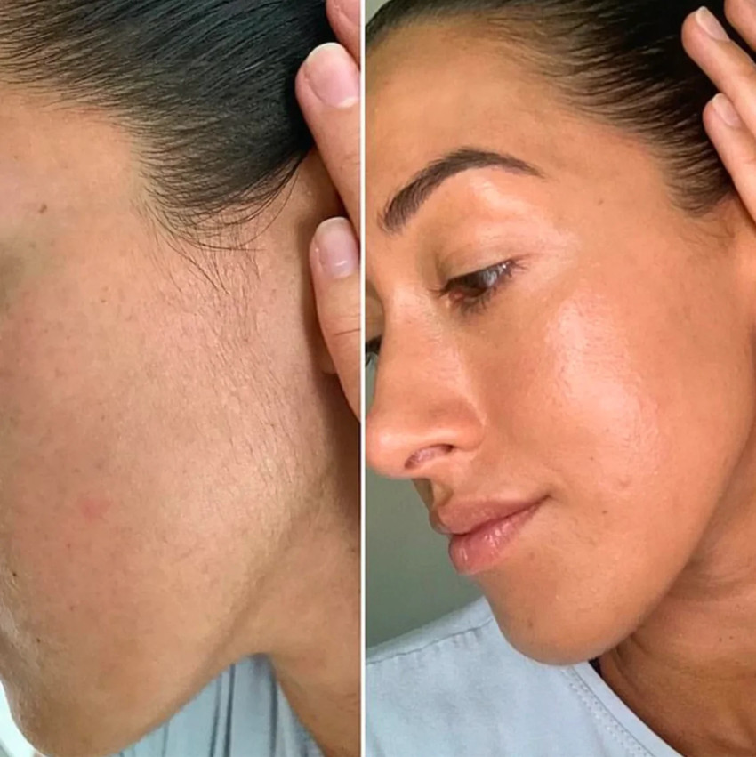 Best hair removal store for face woman