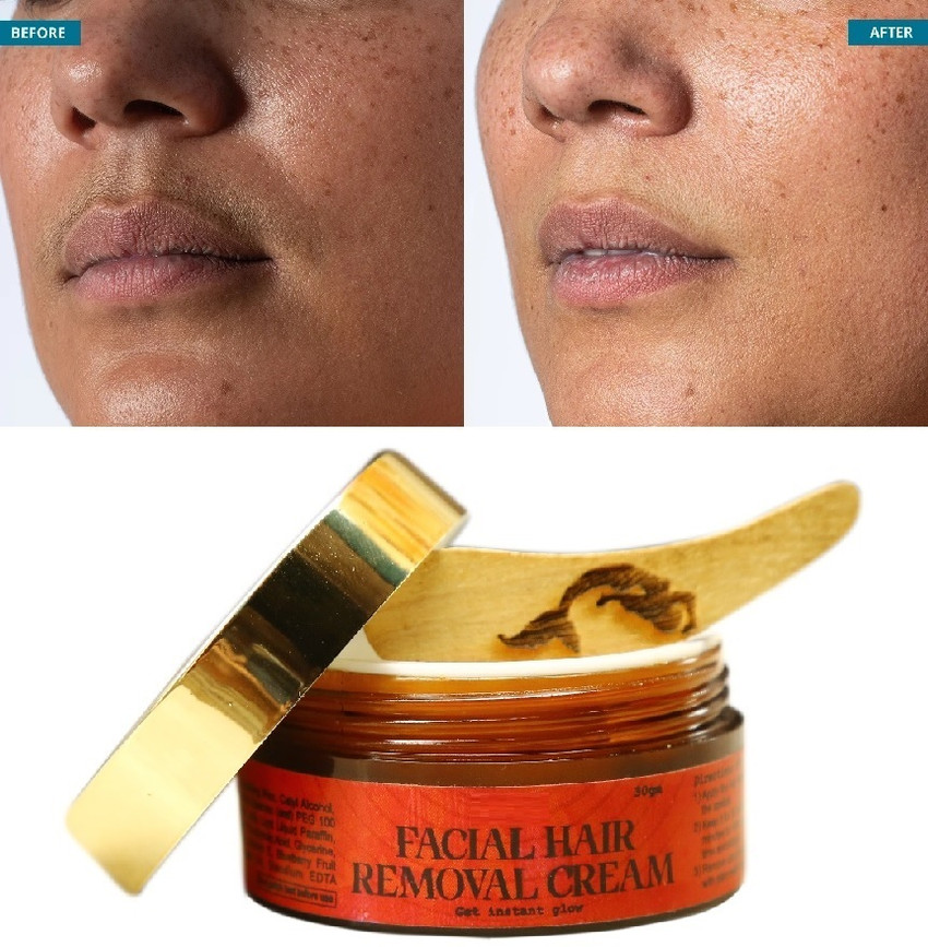 Details 131+ chin hair removal cream best ceg.edu.vn