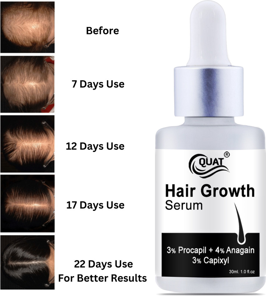 Discover more than 149 do hair growth serums work camera.edu.vn