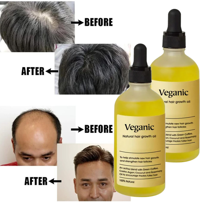 Veganic Natural Hair growth oil for Stress Relief Weak Hair Hair Oil Price in India Buy Veganic Natural Hair growth oil for Stress Relief Weak Hair Hair Oil Online In India