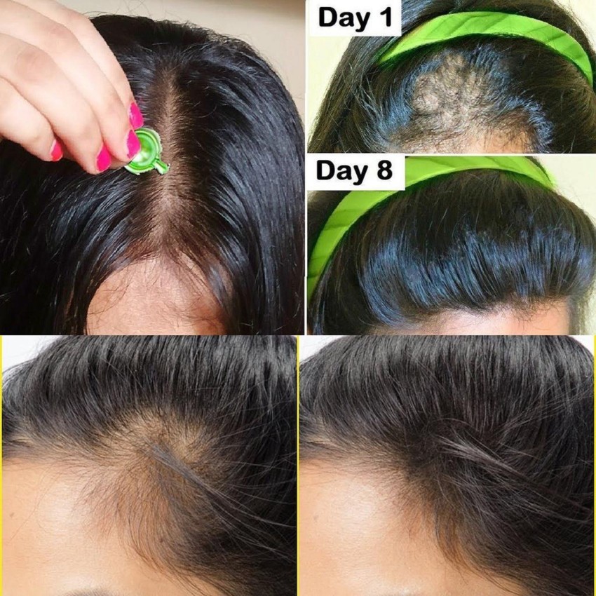 Serum Dưỡng Tóc Ellips Vitamin Hair Vitamin Moroccan Oil Jar Hũ 50 Viên |  Lazada.vn