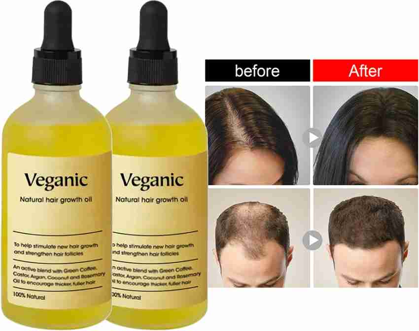 Veganic Natural Hair growth oil for Straightening Smoothening New Hair Price in India Buy Veganic Natural Hair growth oil for Straightening Smoothening New Hair Online In India Reviews Ratings Feature...