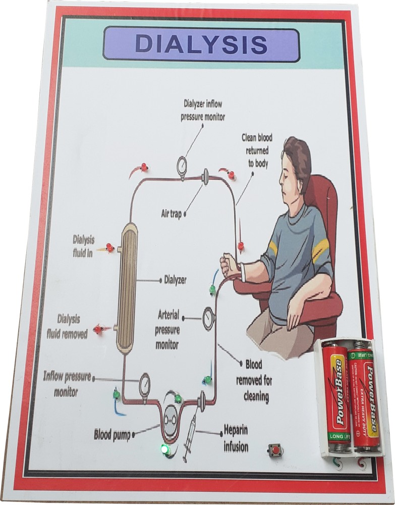 Dialysis Working Model For Science Project Exhibition Free, 41% OFF