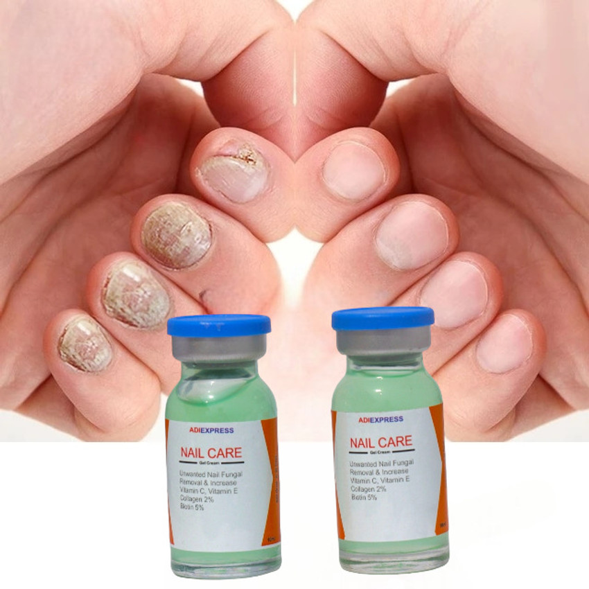 Discover 148+ nail growth in 5 days best songngunhatanh.edu.vn