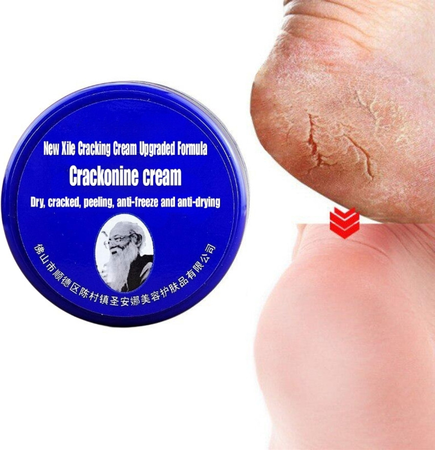 Leg crack hot sale