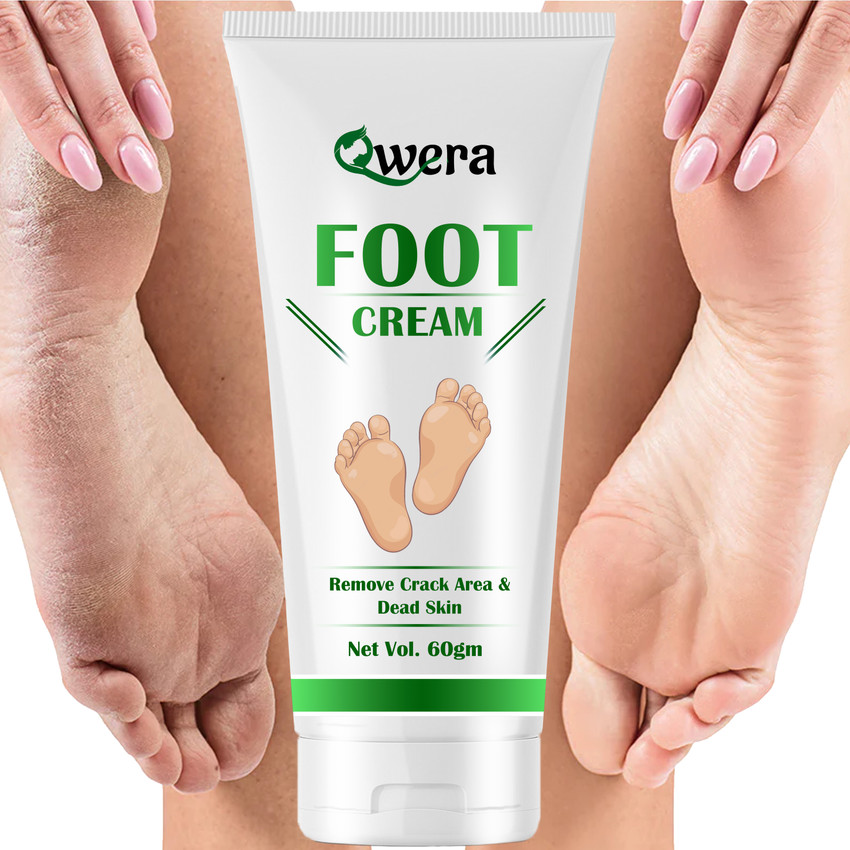 Best foot cream for cracked heels 218 deals