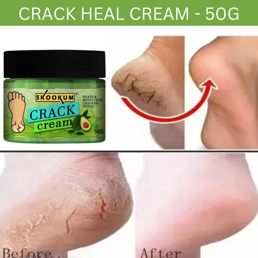 SKOOKUM Feet Crack Heel Repair Cream for Moisturizes and Soothes Feet Price in India Buy SKOOKUM Feet Crack Heel Repair Cream for Moisturizes and Soothes Feet Online In India Reviews Ratings