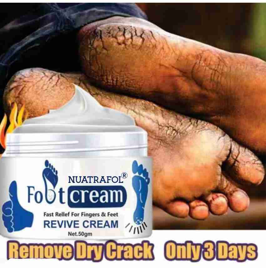 Toe best sale crack cream