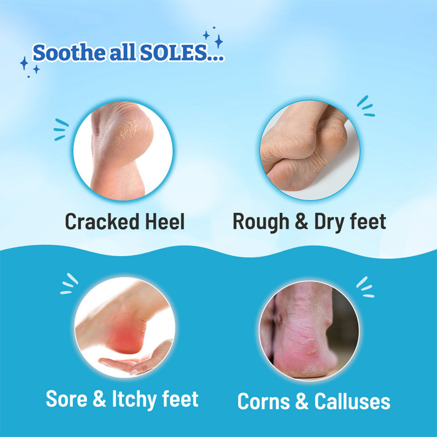 Foot cream for dry heels online