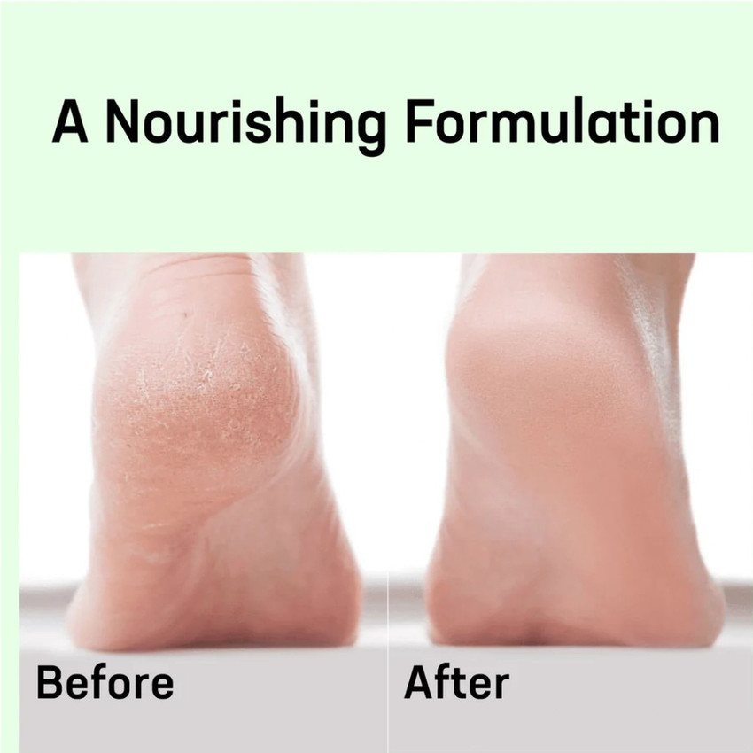 White Leaf Froot Crack Heel Repair Cream Winter Foot Cream For