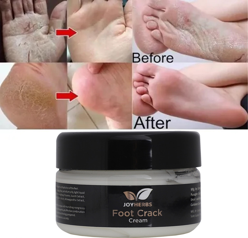 JOYHERBS Nuatrafol Foot Crack Cream For Dry Cracked Heels Feet