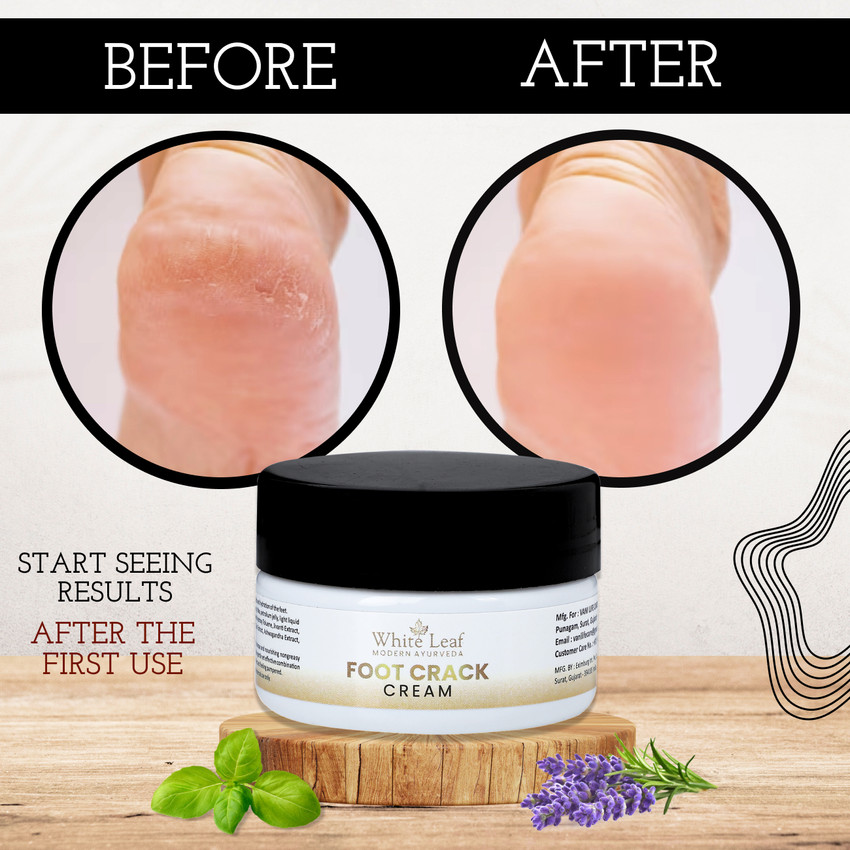 Feet cream to remove dead skin shop
