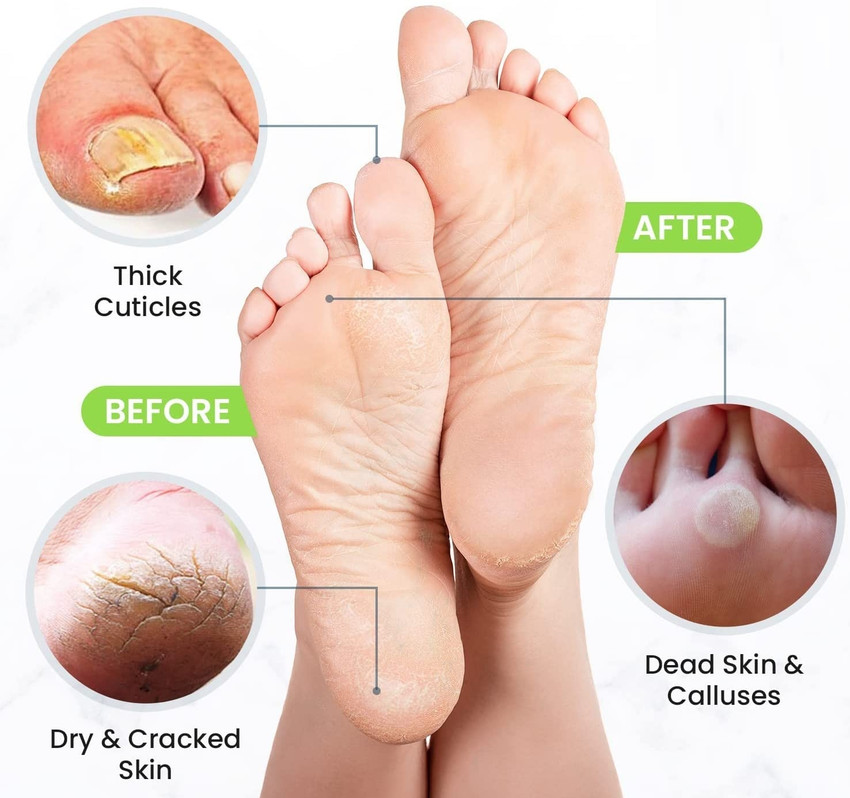 MYEONG ry Cracked Feet and Smelly Feet Foot Repair Cream Price in India Buy MYEONG ry Cracked Feet and Smelly Feet Foot Repair Cream Online In India Reviews Ratings Features