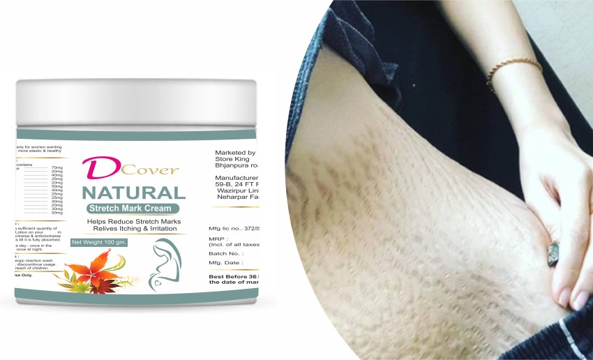 All Best Natural Stretch Mark Cream