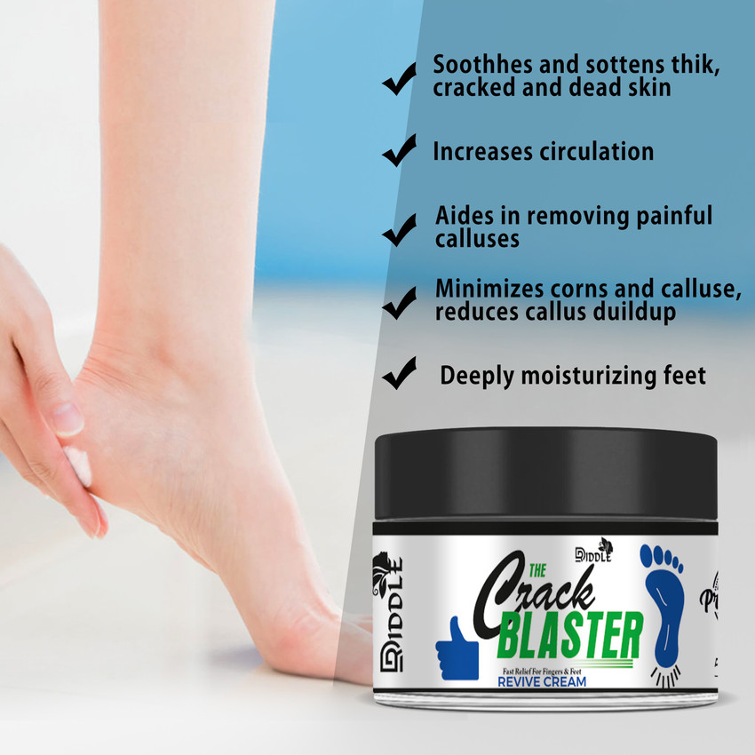 Instant cracked heel relief store