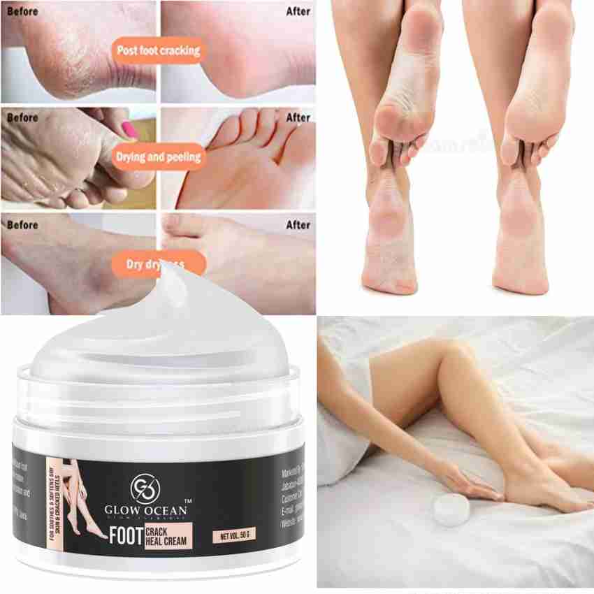 glowocean Foot Crack Heel Cream For Smooth Cracked Heel Repair