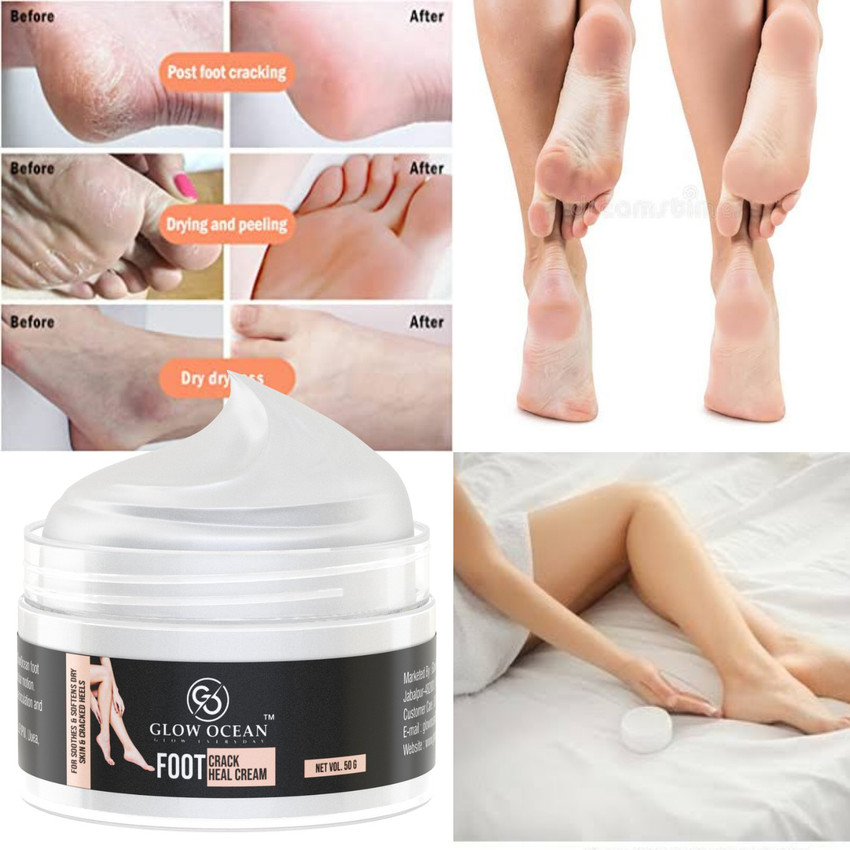 Crack heal cream sales