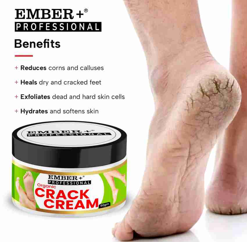 Ember Cream For Rough Dry and Cracked Heel And Hand Feet And Hand Cream For Healing Price in India Buy Ember Cream For Rough Dry and Cracked Heel And Hand Feet