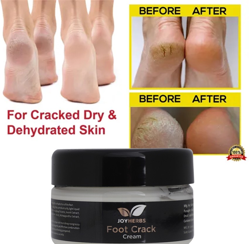 Feet cream to remove dead clearance skin