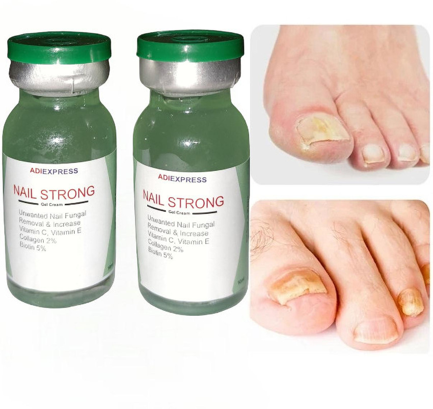 Discover 148+ nail growth in 5 days best songngunhatanh.edu.vn