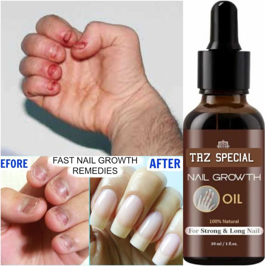 Miracle GrowTH Cuticle & Nail Oil Pen - 3ml Refillable Applicator – K.N.I.  Beauty & Bath