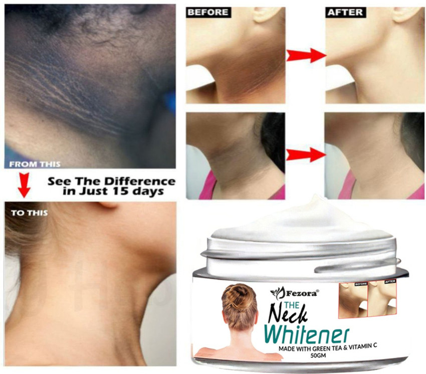 Neck cheap whitening cream