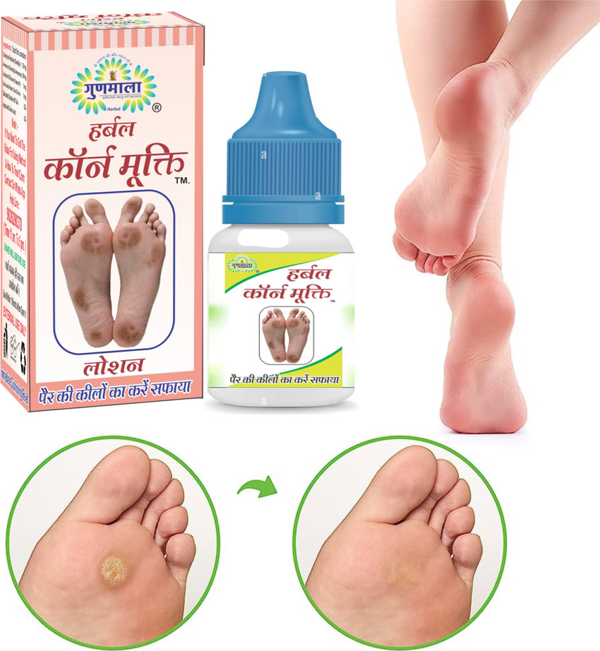 Gunmala Corn Removal Lotion For Dry Hard Foot Corns Repair swelling Pain Relief 15 Ml Price in India Buy Gunmala Corn Removal Lotion For Dry Hard Foot Corns Repair swelling Pain
