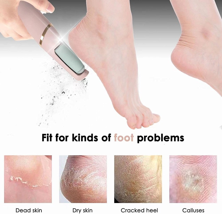 HANNEA Electric Callus Remover, Foot scrubber for dead skin Removal,  Professional Pedicure Kits with 3 Rollers