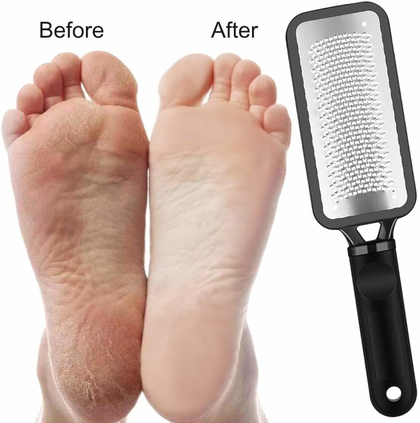 Foot File Hard Dead Skin Callus Remover Rasp Scraper Dead Skin Scrubber  Black