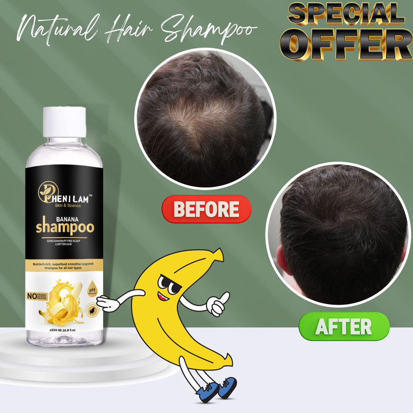 Top more than 138 banana curd hair mask super hot ceg.edu.vn