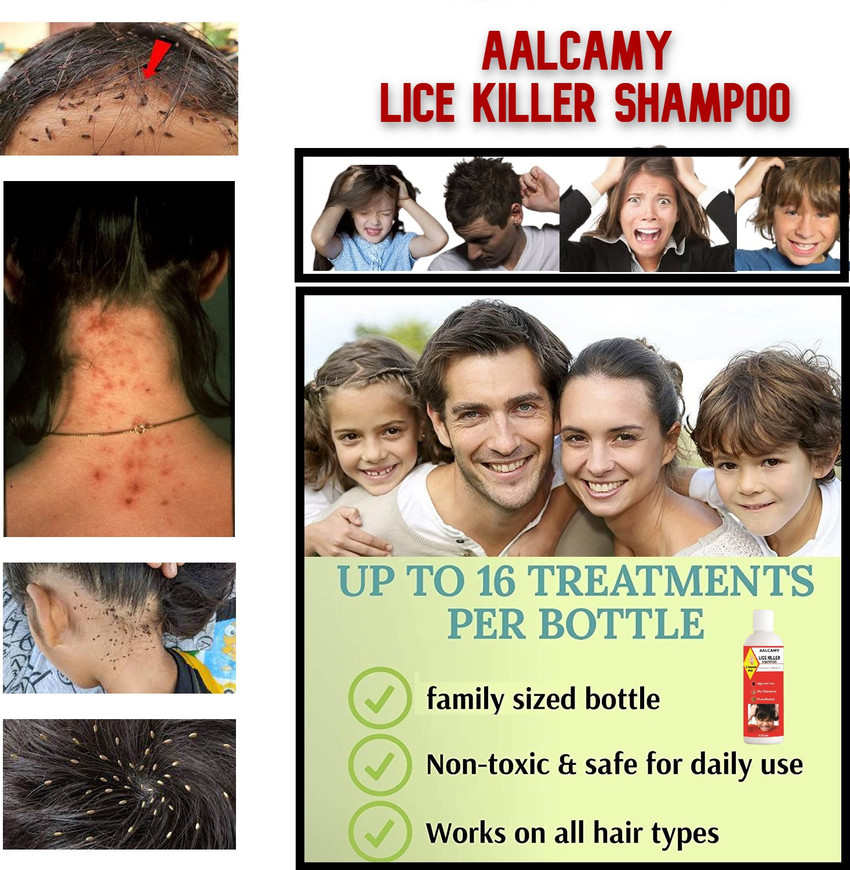Update 71+ hair insects shampoo best ceg.edu.vn