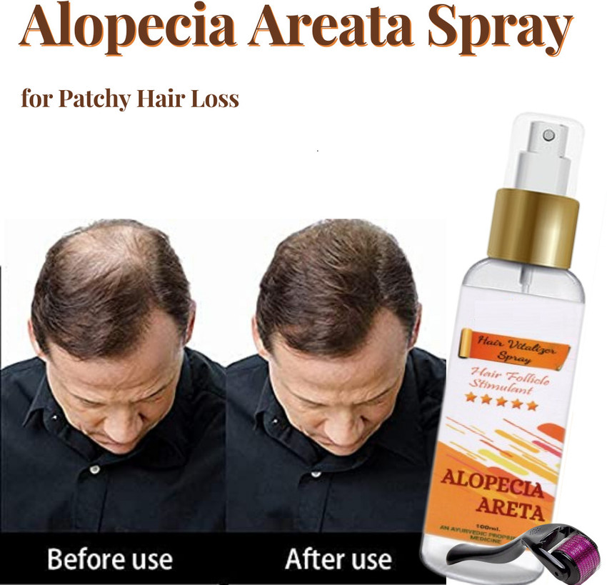Bello Me Hair Growth Spray: Revitalize Your Roots - Anti-Alopecia Areata Spray & Roller | Hair Oil - Price in India, Buy Bello Me Hair Growth Spray: Revitalize Your Roots - Anti-Alopecia