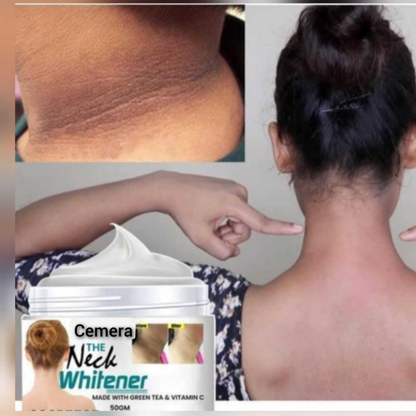 Black neck best sale remove cream