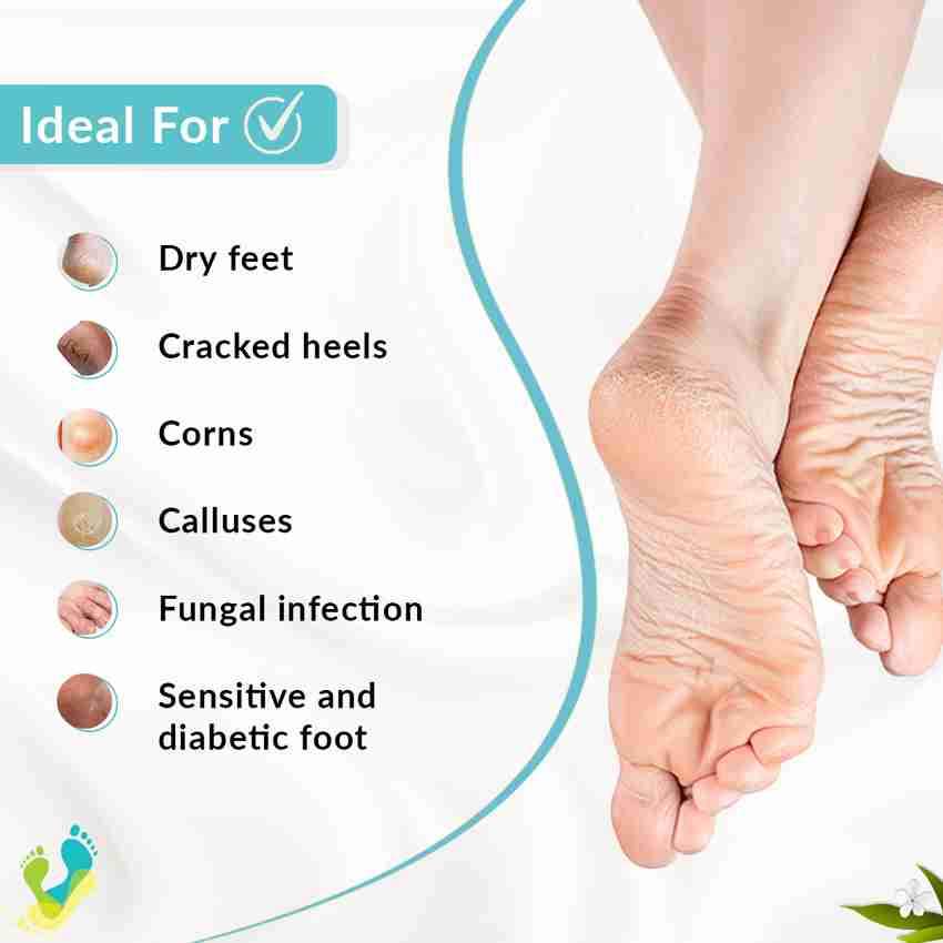 Fixderma Foobetik Cream Foot Cream for Dry Cracked Feet Moisturizes Repair Feet Price in India Buy Fixderma Foobetik Cream Foot Cream for Dry Cracked Feet Moisturizes Repair