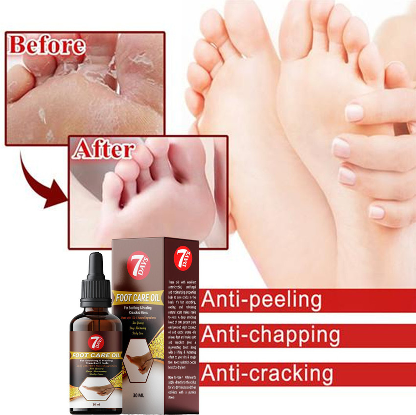 7 Days Feet for Heel Repair Smooth Foot Crack Cracked Heel Repair Foot Cream foot cream for cracked heels for men women stretch mark scar spot black head removal cream Price