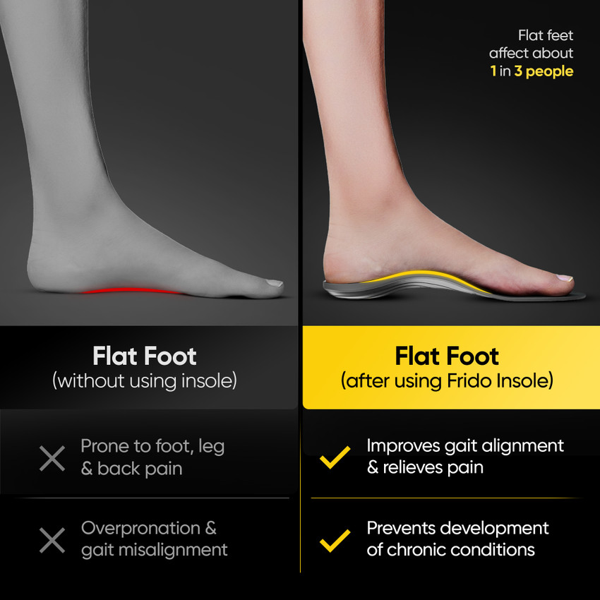 Frido Arch Support Rigid Insole for Flat Feet Relieves Feet Pain Large 9 11 UK Foot Support Buy Frido Arch Support Rigid Insole for Flat Feet Relieves Feet Pain Large 9 11 UK