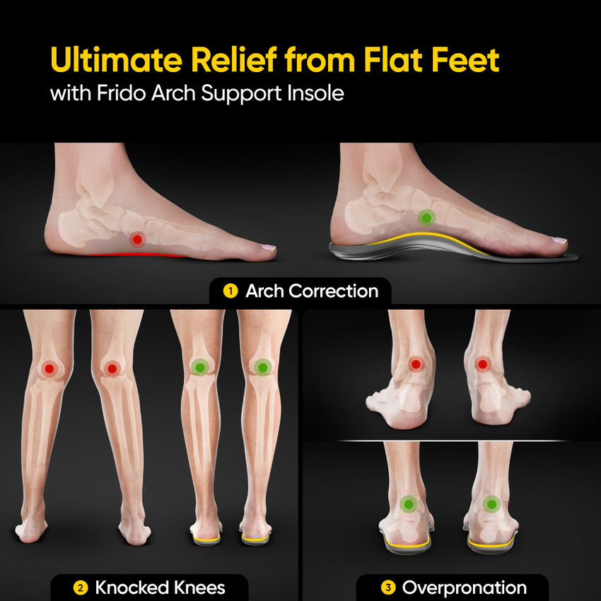 Of Foot Pain Relief For Fallen Arches Frido Arch Support Rigid