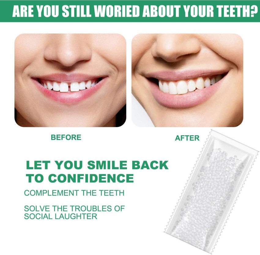 https://rukminim2.flixcart.com/image/850/1000/xif0q/teeth-whitening-kit/e/e/j/diy-tooth-filling-thermal-beads-temporary-teeth-repair-moldable-original-imagkqgttthggzvu.jpeg