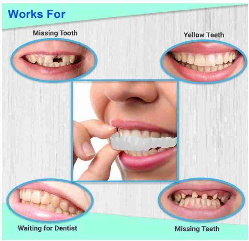 SILNOVO Moldable Teeth Veneers with Adhesive Fitting Beads Temporary False Teeth  Teeth Wipe Price in India - Buy SILNOVO Moldable Teeth Veneers with  Adhesive Fitting Beads Temporary False Teeth Teeth Wipe online